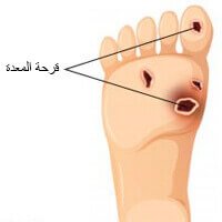 التهابات السكري المزمنة